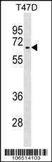 Anti-Activin Receptor Type IA (ACVR1) (Center N99) Antibody