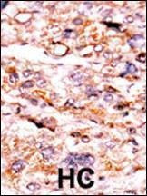 Anti-ACVR2A (N-term) Antibody