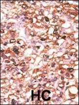 Anti-ACVR2B (N-term) Antibody