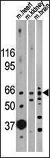 Anti-ACVR2B (N-term) Antibody