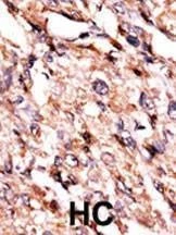 Anti-BCKDK (Center) Antibody