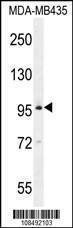 Anti-BRDT (N-term) Antibody