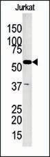 Anti-Glycerol kinase (GPK2) (C-term) Antibody