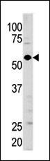 Anti-Guanylyl Cyclase alpha 1 (GUCY1A3) (N-term) Antibody