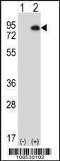 Anti-HIPK4 (C-term) Antibody
