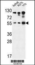 Anti-AKT1 (S129) Antibody