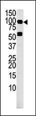 Anti-MARK4 (C-term) Antibody