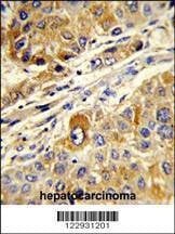 Anti-MASTL Antibody