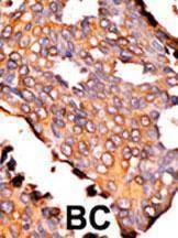Anti-RFK (N-term) Antibody