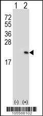 Anti-RFK (N-term) Antibody