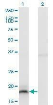 Anti-IFNA13 Antibody