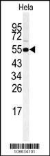 Anti-RIPK3 (Center) Antibody