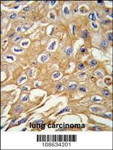 Anti-RIPK3 (Center) Antibody