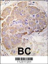 Anti-HSPB1 (S82) Antibody