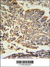 Anti-HSP27 (Center) Antibody