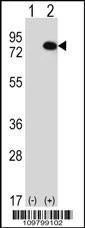 Anti-RIOK1 (N-term) Antibody