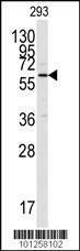Anti-CAMK2A (CAMK2 alpha) (C-term) Antibody