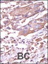 Anti-CAMK2A (CAMK2 alpha) (C-term) Antibody
