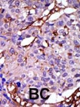 Anti-CASK (C-term) Antibody