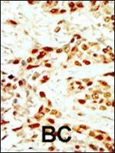 Anti-DAPK2 (N-term) Antibody