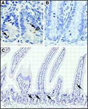 Anti-DCAMKL1 (C-term) Antibody