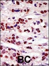 Anti-DRAK2 (C-term) Antibody
