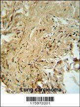 Anti-MAPK14 (T180/Y182) Antibody