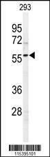 Anti-SPHK1 (C-term R414) Antibody