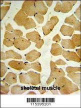 Anti-SPHK1 (C-term R414) Antibody
