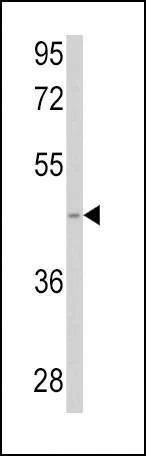 Anti-SPHK1 (Center) Antibody