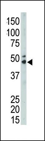 Anti-SPHK1 (Center) Antibody