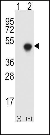 Anti-SPHK1 (Center) Antibody