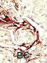 Anti-STK11 (LKB1) (N-term I29) Antibody