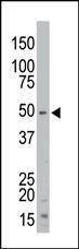 Anti-STK35 (Center) Antibody