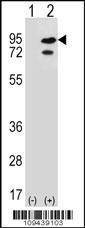 Anti-SNRK (Center) Antibody