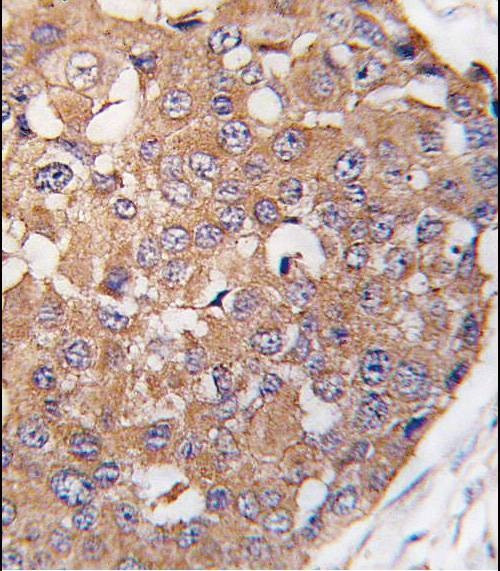 Anti-PLK2 (SNK) (C-term) Antibody