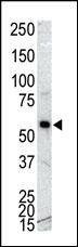 Anti-CAMK1G (CaMKI gamma) (C-term) Antibody