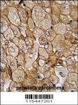 Anti-CAMK1G (Center K226) Antibody