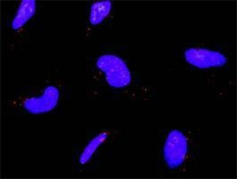 Anti-IKBKB Antibody