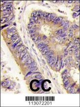 Anti-PIST (Center) Antibody