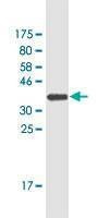 Anti-IL12B Antibody