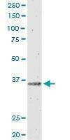 Anti-IL12B Antibody