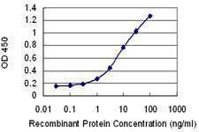 Anti-IL12B Antibody