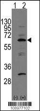Anti-NAE1 (APPBP1) (C-term) Antibody