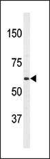 Anti-PAT1 (APPBP2) (Center) Antibody