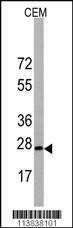 Anti-BarX1 (C-term) Antibody