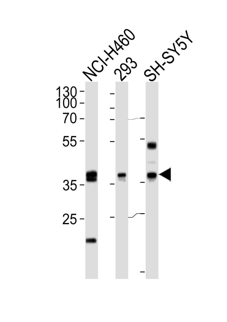 Anti-EN1 (Engrailed 1) (N-term) Antibody