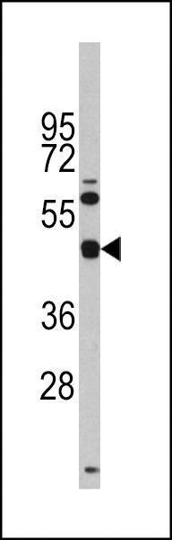 Anti-TGIF (Center L223) Antibody