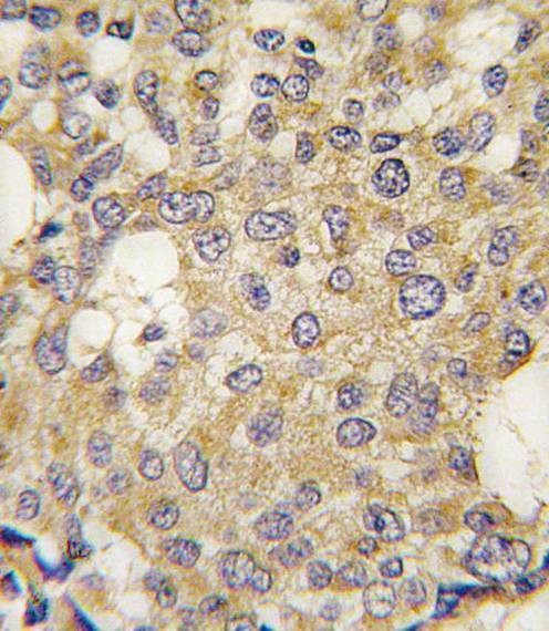 Anti-Parg (C-term) Antibody