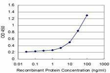 Anti-IL12RB2 Antibody